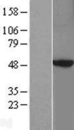 Novus Biologicals&trade;&nbsp;PKA 2 beta Overexpression Lysate