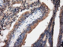 PKA R2 Antibody (OTI1F8), Novus Biologicals 0.1mL; Unlabeled:Antibodies,