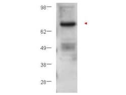 PKC beta Antibody, Novus Biologicals 0.1mg; Unlabeled:Antibodies, Polyclonal
