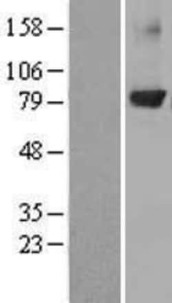 Novus Biologicals&trade;&nbsp;PKC beta Overexpression Lysate