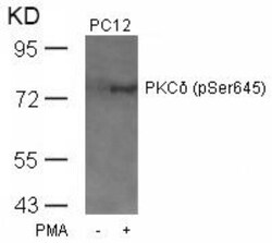 PKC delta, p Ser645 Antibody, Novus Biologicals 0.025 mL | Buy Online | Novus Biologicals | Fisher Scientific