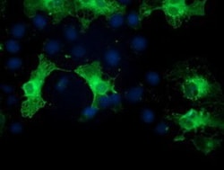 PKC epsilon Antibody (OTI4G8), Novus Biologicals 0.1mL; Unlabeled:Antibodies,