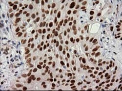PKC epsilon Antibody (OTI4G8), Novus Biologicals 0.1mL; Unlabeled:Antibodies,