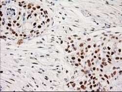 PKC epsilon Antibody (OTI4G8), Novus Biologicals 0.1mL; Unlabeled:Antibodies,