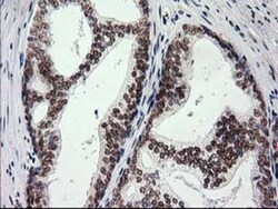 PKC epsilon Antibody (OTI4G8), Novus Biologicals 0.1mL; Unlabeled:Antibodies,