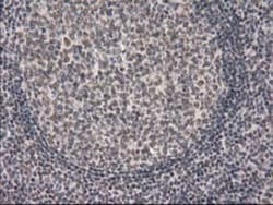 PKC epsilon Antibody (OTI4G8), Novus Biologicals 0.1mL; Unlabeled:Antibodies,
