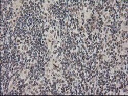 PKC epsilon Antibody (OTI4G8), Novus Biologicals 0.1mL; Unlabeled:Antibodies,