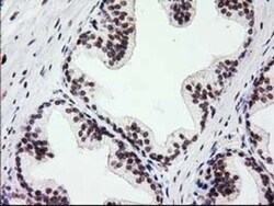 PKC epsilon Antibody (OTI4G8), Novus Biologicals 0.1mL; Unlabeled:Antibodies,