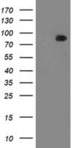 PKC epsilon Antibody (OTI4G8), Novus Biologicals 0.1mL; Unlabeled:Antibodies,