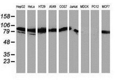 PKC epsilon Antibody (OTI4G8), Novus Biologicals 0.1mL; Unlabeled:Antibodies,