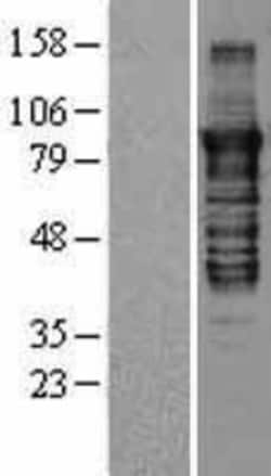 Novus Biologicals&trade;&nbsp;PKC epsilon Overexpression Lysate