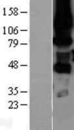 Novus Biologicals&trade;&nbsp;PKC eta Overexpression Lysate