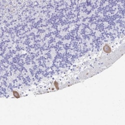 PKC gamma Antibody, Novus Biologicals 0.1mL; Unlabeled:Antibodies, Polyclonal