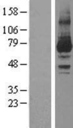Novus Biologicals&trade;&nbsp;PKC iota Overexpression Lysate