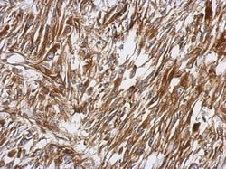 PKC theta Antibody, Novus Biologicals 0.1mL; Unlabeled:Antibodies, Polyclonal