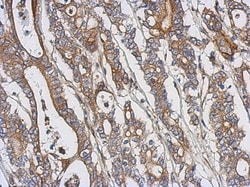 PKC theta Antibody, Novus Biologicals 0.1mL; Unlabeled:Antibodies, Polyclonal