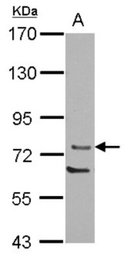 PKC theta Antibody, Novus Biologicals 0.1mL; Unlabeled:Antibodies, Polyclonal