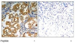 PKC zeta Antibody, Novus Biologicals 0.1 mg; Unconjugated:Antibodies, Polyclonal