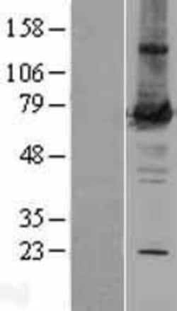 Novus Biologicals&trade;&nbsp;PKC zeta Overexpression Lysate