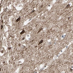 PKC alpha Antibody, Novus Biologicals 25 &mu;L; Unlabeled:Antibodies, Polyclonal