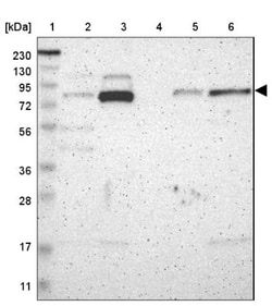 PKC alpha Antibody, Novus Biologicals 25 &mu;L; Unlabeled:Antibodies, Polyclonal