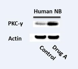 PKC gamma Antibody, Novus Biologicals 100 &mu;L | Buy Online | Novus Biologicals | Fisher Scientific