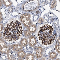 PKD1L1 Antibody, Novus Biologicals 0.1mL; Unlabeled:Antibodies, Polyclonal