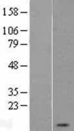 Novus Biologicals&trade;&nbsp;PKI-alpha Overexpression Lysate