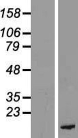 Novus Biologicals&trade;&nbsp;PKI-beta Overexpression Lysate
