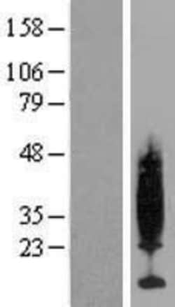Novus Biologicals&trade;&nbsp;PKIG Overexpression Lysate