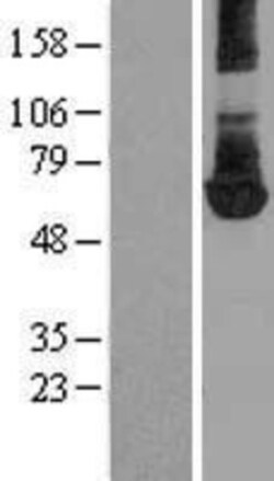 Novus Biologicals&trade;&nbsp;PKM2 Overexpression Lysate