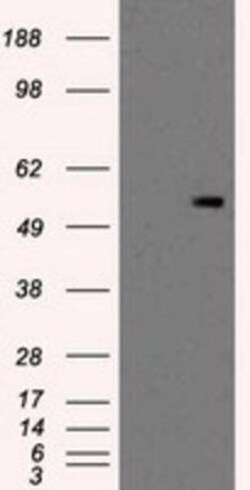 PKMYT1 Antibody (OTI5E1), Novus Biologicals 0.1mL; Unlabeled:Antibodies,
