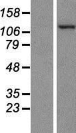 Novus Biologicals&trade;&nbsp;PKN2 Overexpression Lysate