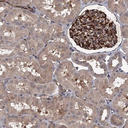 PKN2 Antibody, Novus Biologicals 25 &mu;L, Unlabeled:Antibodies, Polyclonal
