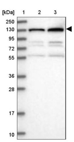 PKN2 Antibody, Novus Biologicals 25 &mu;L, Unlabeled:Antibodies, Polyclonal