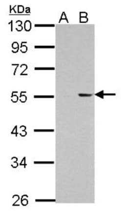 PKNOX1 Antibody, Novus Biologicals 0.1mL; Unlabeled:Antibodies, Polyclonal
