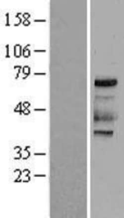 Novus Biologicals&trade;&nbsp;PKR Overexpression Lysate