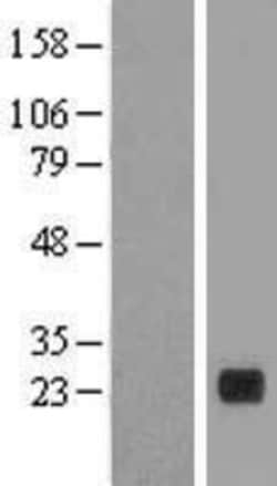 Novus Biologicals&trade;&nbsp;PLA2G12B Overexpression Lysate