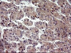 PLA2G16/HRASLS3 Antibody (OTI1A5), Novus Biologicals 0.1mL; Unlabeled:Antibodies,