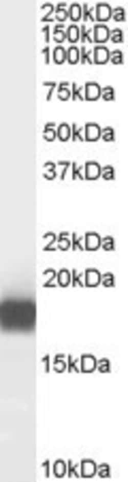 PLA2G1B Antibody, Novus Biologicals 0.1mg; Unlabeled:Antibodies, Polyclonal