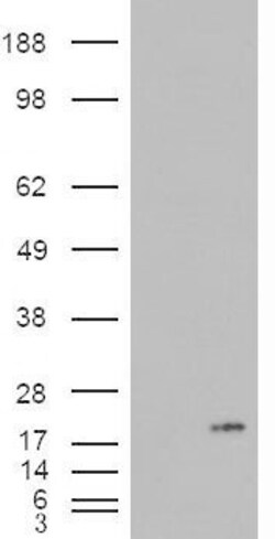 PLA2G1B Antibody, Novus Biologicals 0.1mg; Unlabeled:Antibodies, Polyclonal