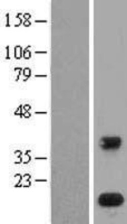 Novus Biologicals™ PLA2G1B Overexpression Lysate