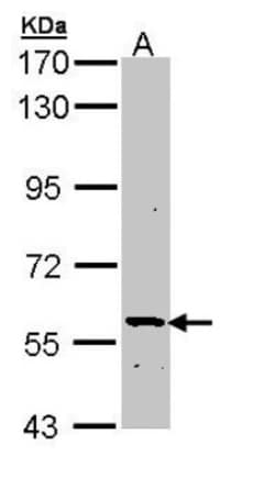 PLA2G3 Antibody, Novus Biologicals 0.1mg; Unlabeled:Antibodies, Polyclonal