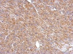 PLA2G4A Antibody, Novus Biologicals 0.1mg; Unlabeled:Antibodies, Polyclonal