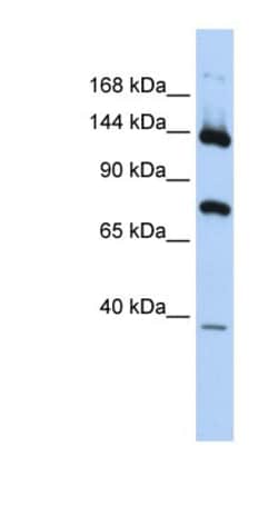 PLA2G4B Antibody, Novus Biologicals:Antibodies:Primary Antibodies