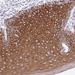 PLA2G4E Antibody, Novus Biologicals 25 &mu;L, Unlabeled:Antibodies, Polyclonal