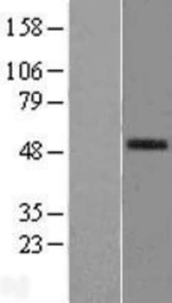 Novus Biologicals™ PLA2G7/PAF-AH/Lp-PLA2 Overexpression Lysate