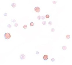 PLAC1 Antibody - BSA Free, Novus Biologicals 0.1mg; Unlabeled:Antibodies,
