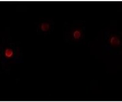 PLAC1 Antibody - BSA Free, Novus Biologicals 0.1mg; Unlabeled:Antibodies,