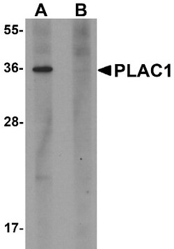 PLAC1 Antibody - BSA Free, Novus Biologicals 0.1mg; Unlabeled:Antibodies,